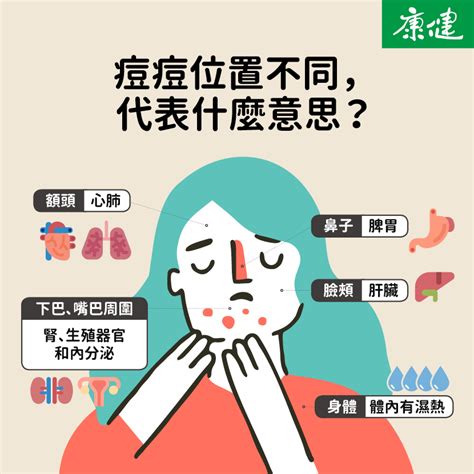 鼻頭痘|痘痘一直好不了？痘痘位置代表什麼？醫師2招治療痘。